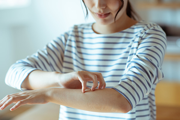 アレルギーのある女性
